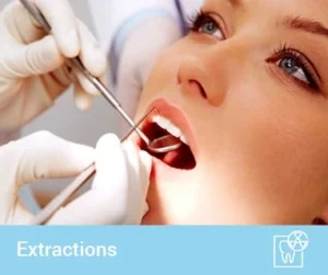 Tooth extraction cost without insurance